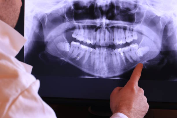 Best Emergency Dental Care for Abscessed Tooth in Oak Hill, TN